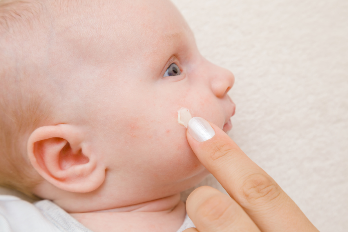 28个月宝宝改善传染性软疣的经历分享~ - 知乎