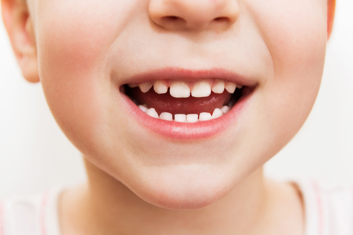 小孩换牙牙分布图及时间（儿童的换牙时间和顺序是什么呢？我们应该注意什么） | 说明书网