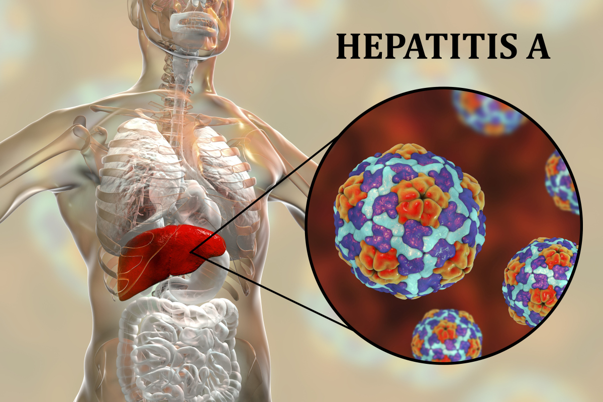 Hepatitis Virus PNG Picture, Liver Hepatitis Virus Infection, Human ...