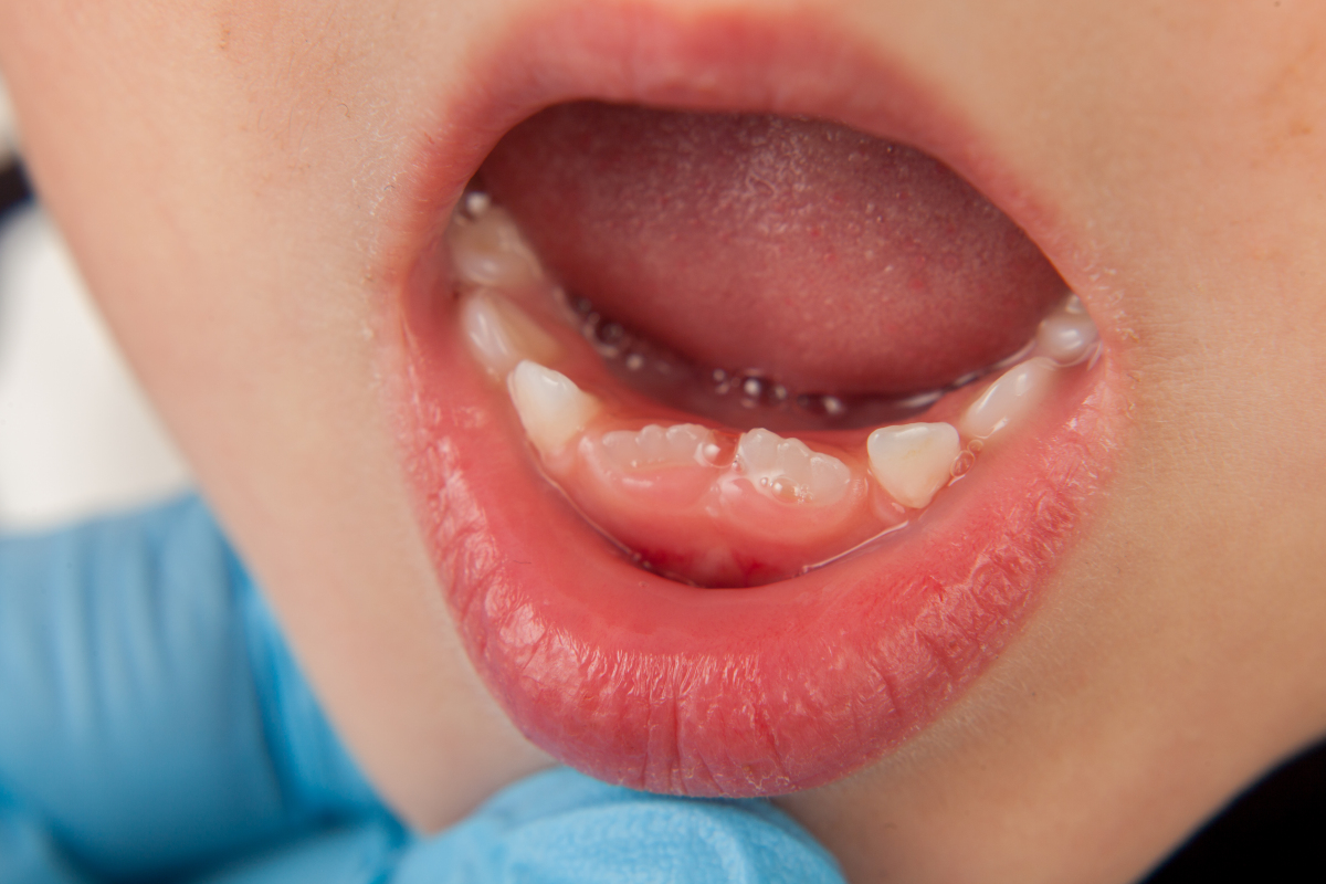 如何保护宝宝的牙齿？做好这5个爱护牙齿的方法是关键 | 说明书网